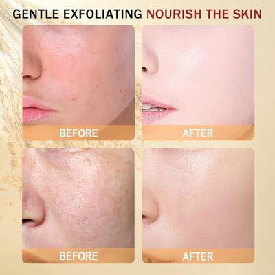 Radiant Skin Rice Exfoliant Duo™