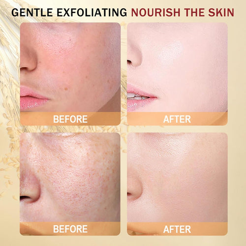 Radiant Skin Rice Exfoliant Duo™